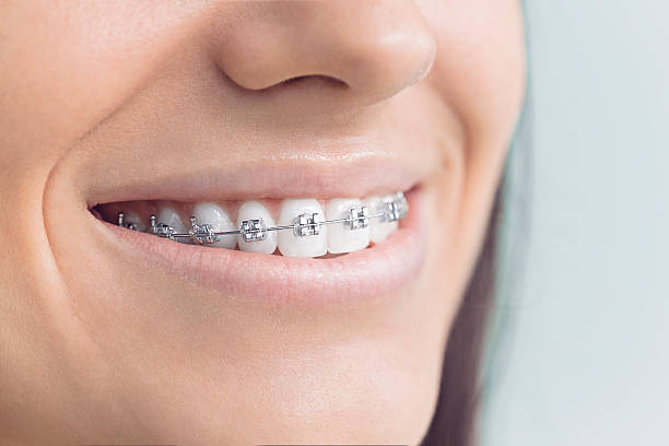 Best Dental Inlays and Onlays  in Amite City, LA